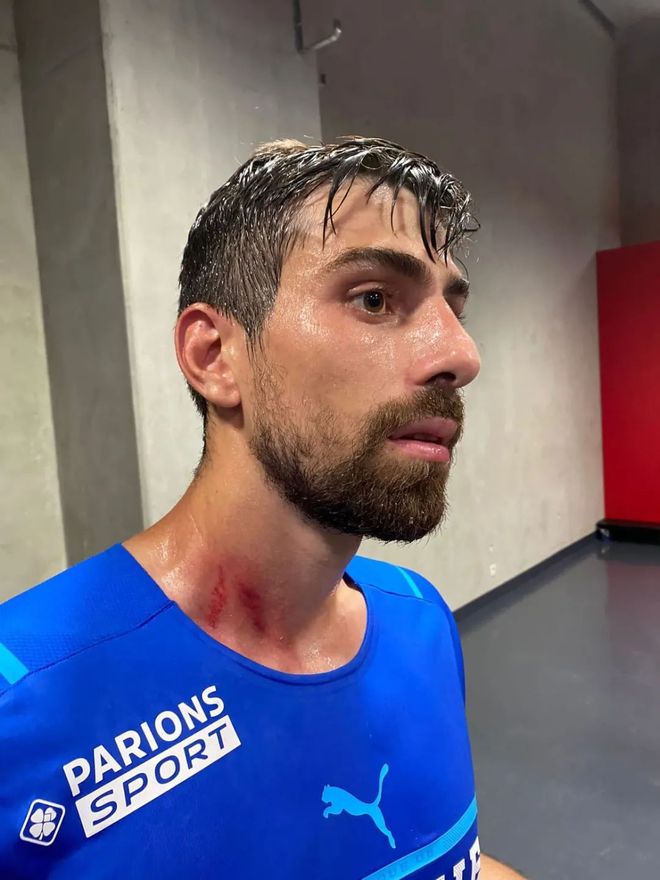 包含太狠了！斯图加特止住颓势备战法甲深圳男篮战术微调备战法甲，门兴格拉德巴赫赛前手感冰凉的词条